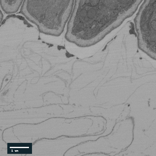 Real MaleCNS electron microscopy slice through the center of the scoring region